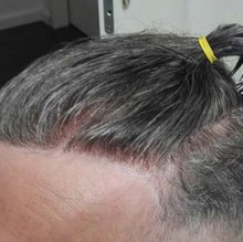 Zweithaarstudio Kiefersfelden Haarteile, Toupets, Haarersatz für Männer, Herren
