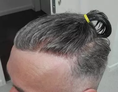 Haare Vorherbild